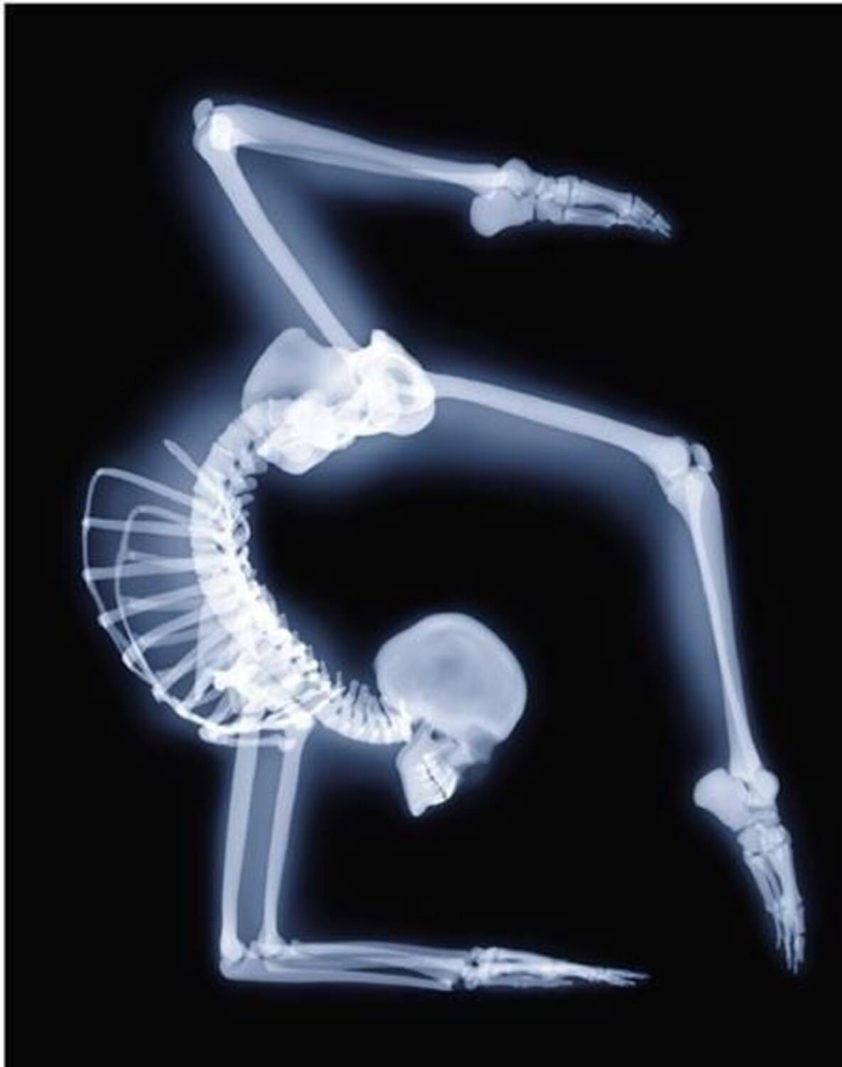 X-ray image shows a gymnast X-ray image shows a gymnast